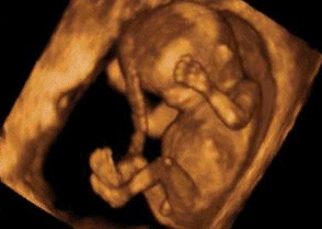 Echographie Obstetricale 3d Centre D Imagerie Medicale De L Etoile