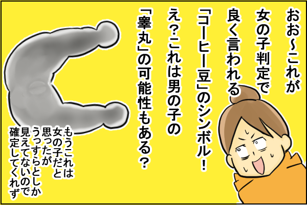 コーヒー豆 見えてるけどまだ性別が分からないって By フクミー ゼクシィbaby 妊娠 出産 育児 みんなの体験記