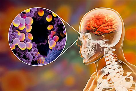 type  severity  cold symptoms  controlled