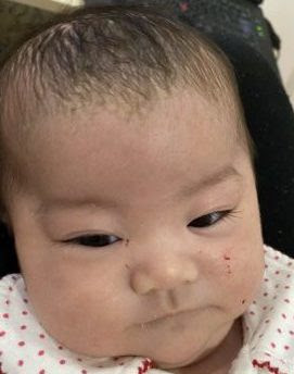 赤ちゃんの顔が傷だらけ でも暴れるから爪切りできない 失敗しない裏技