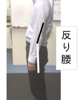 反り腰 の実態って知っていますか 反り腰 を完全理解して治す R Door アールドア バランス院 広島市南区のバランス院