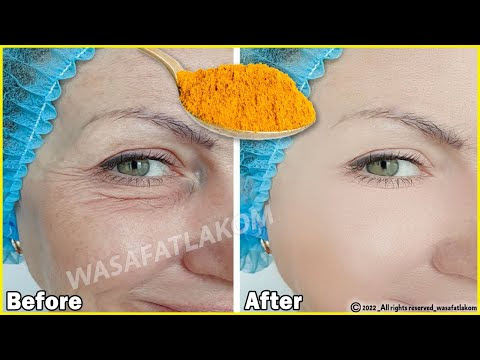 Even if you are 70, 🌹 apply it to wrinkles, it will make your face taut like glass / Stronger botox