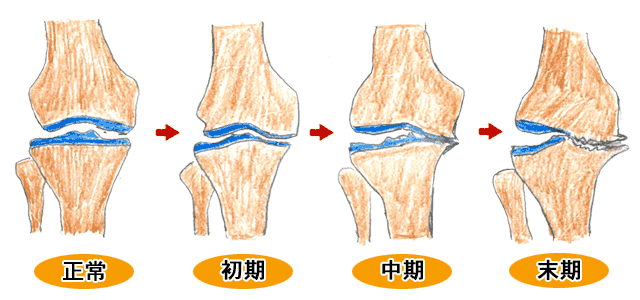 田尻整形外科 Q A 質問と回答