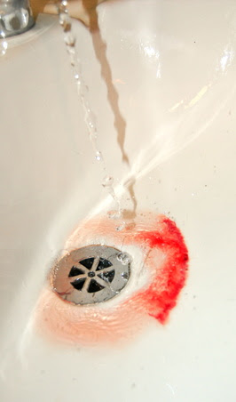 termination of pregnancy