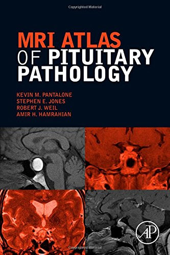 MRI Atlas of Pituitary Pathology, by Kevin M. Pantalone DO  ECNU  CCD, Stephen E. Jones PhD, Robert J. Weil, Amir H. Hamrahian