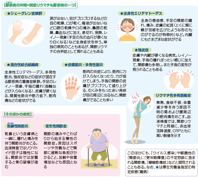 関節リウマチと間違われやすい病気 合併しやすい病気 診断と治療法の決定 関節リウマチ 治療と予防 痛みの原因と治療法 Qlife痛み