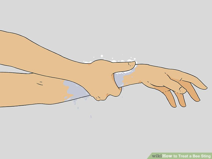 Treat a Bee Sting Step 2 Version 3.jpg