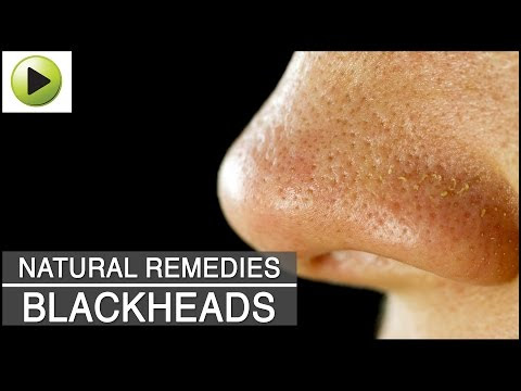  Skin Care - Blackheads - Natural Ayurvedic Home Remedies