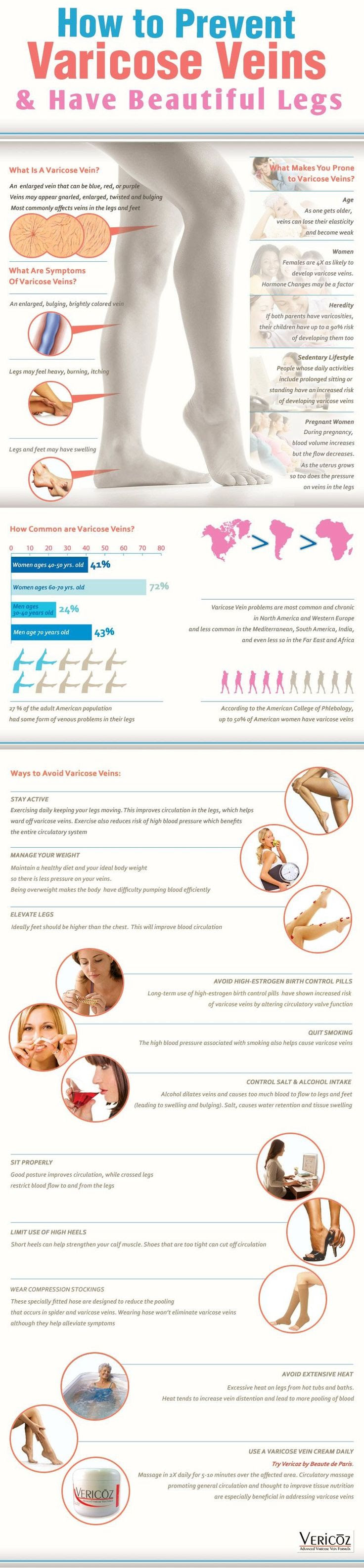 Tips on How to Help Prevent Varicose Veins During Pregnancy