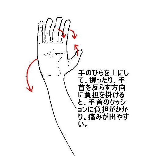 整形外科の病気の話９ 赤坂整形外科