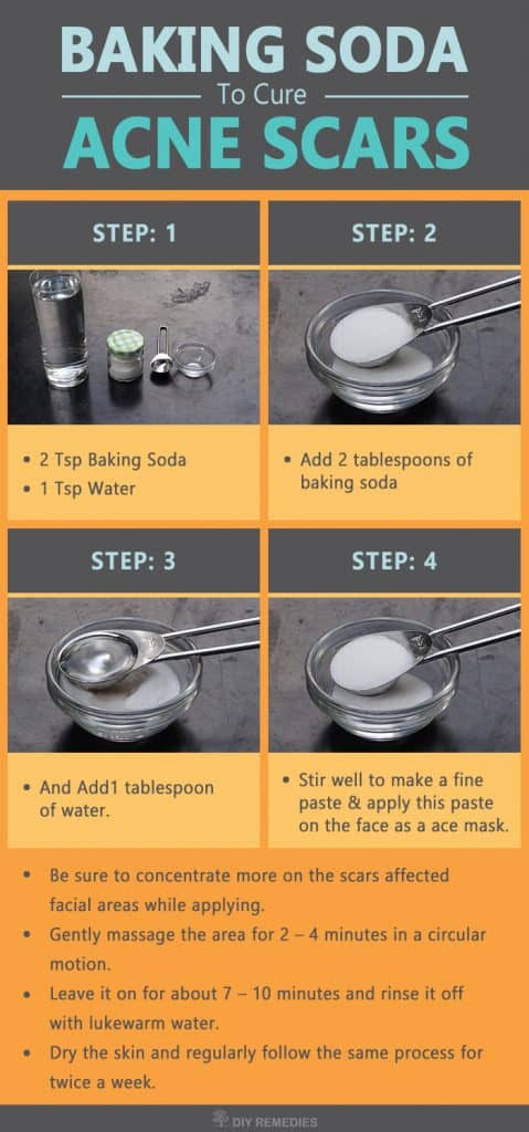 How to Get Rid of Acne Scars using Baking Soda - DIY Natural Home 