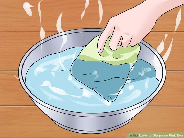Diagnose Pink Eye Step 11.jpg