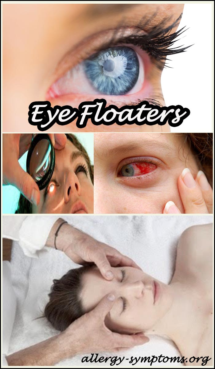 10 Ways to get rid of Eye Floaters at Home - Allergy-symptoms.org