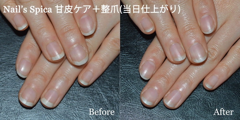 Nail S Spica 広島市中区中町のネイルサロン 自爪の形がキレイに生え変わる施術 深爪矯正 深爪改善 巻き爪改善 フルオーダメイドのデザインネイル キャラネイル 痛ネイル ブライダルネイル 大人ネイル ペット同伴可