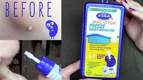 Stop use indications · directions. Dr scholls wart remover review, THAIPOLICEPLUS.COM