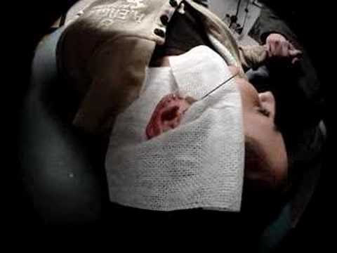 Tags: tragus piercing pierce pierced