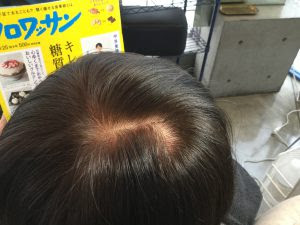つむじ割れ解消 敦賀市 美容室 イマージュ ビス Hair Images Bis