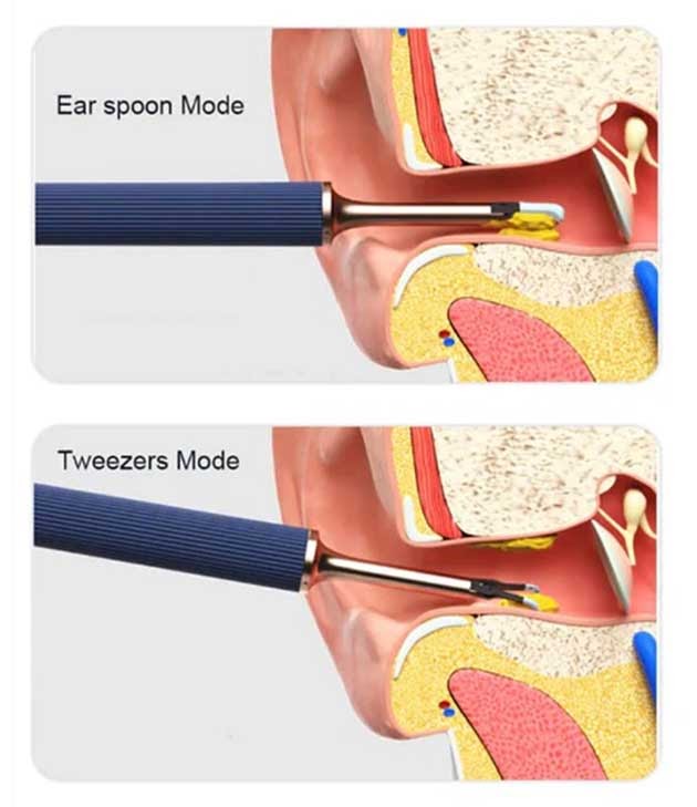 What Is the Best Way to Clean Ears Safely?