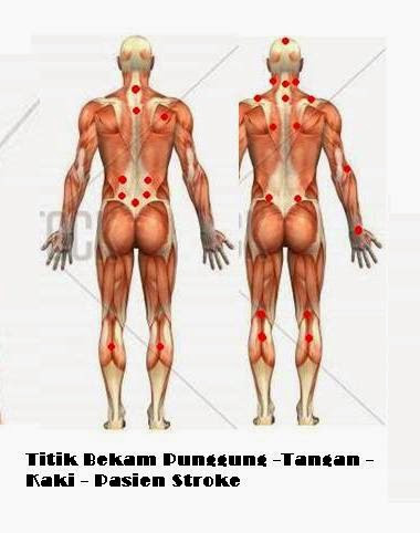 ubat hilangkan parut jerawat hitam   84