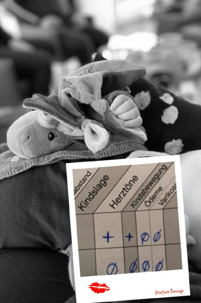 Ultraschall Fehldiagnosen Geburt In Eigenregie