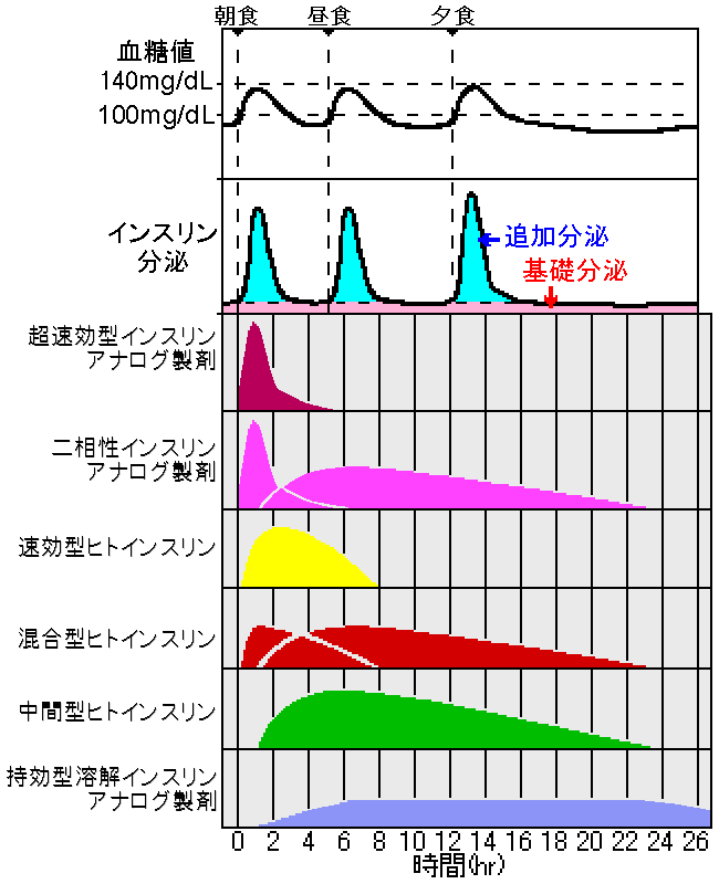 インスリン治療