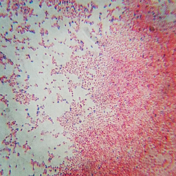 #salmonella under 100,000x magnification #microbiology # ...