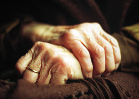  Parkinson's disease  