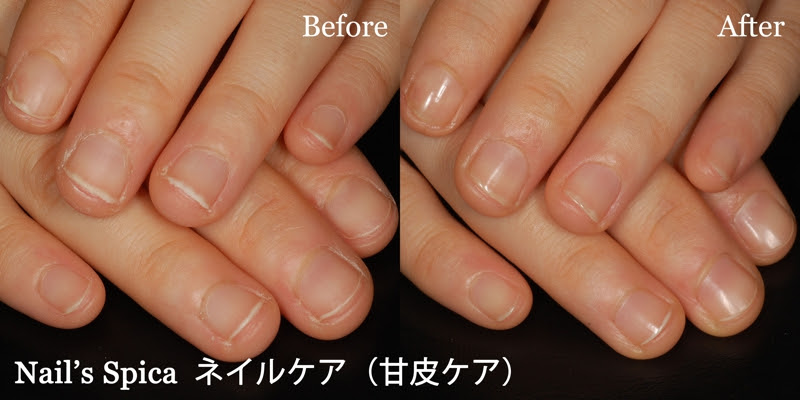 Nail S Spica 広島市中区中町のネイルサロン 自爪の形がキレイに生え変わる施術 深爪矯正 深爪改善 巻き爪改善 フルオーダメイドのデザイン ネイル キャラネイル 痛ネイル ブライダルネイル 大人ネイル ペット同伴可