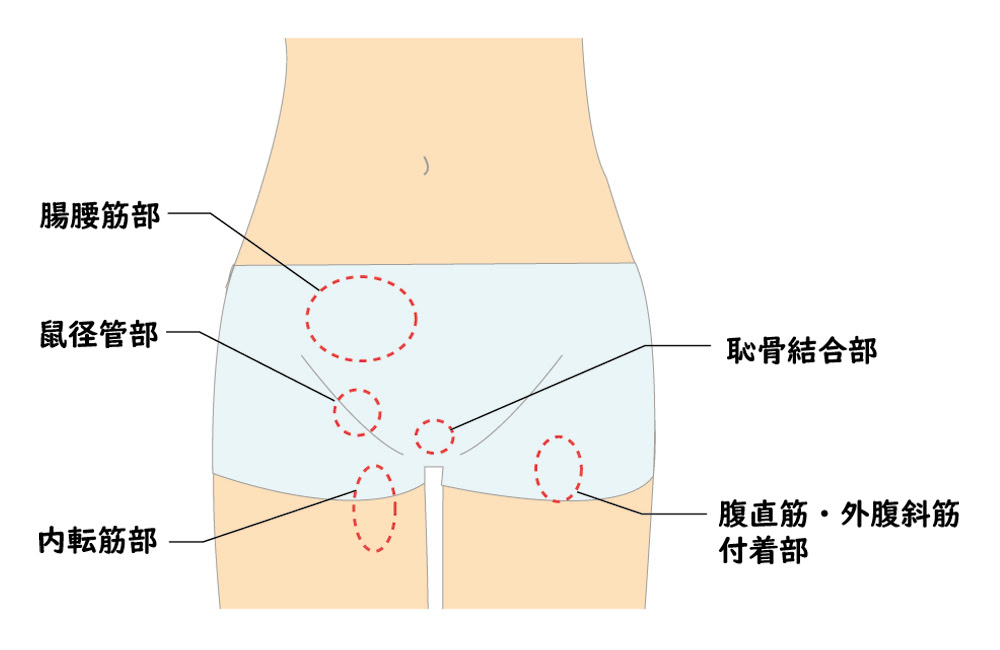 バレエ ダンスに多い怪我とその症状 股関節 骨盤編