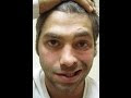 Bell's Palsy Exercises : Do The Facial Exercises #BeautySecrets | Men and Women Beauty Secrets