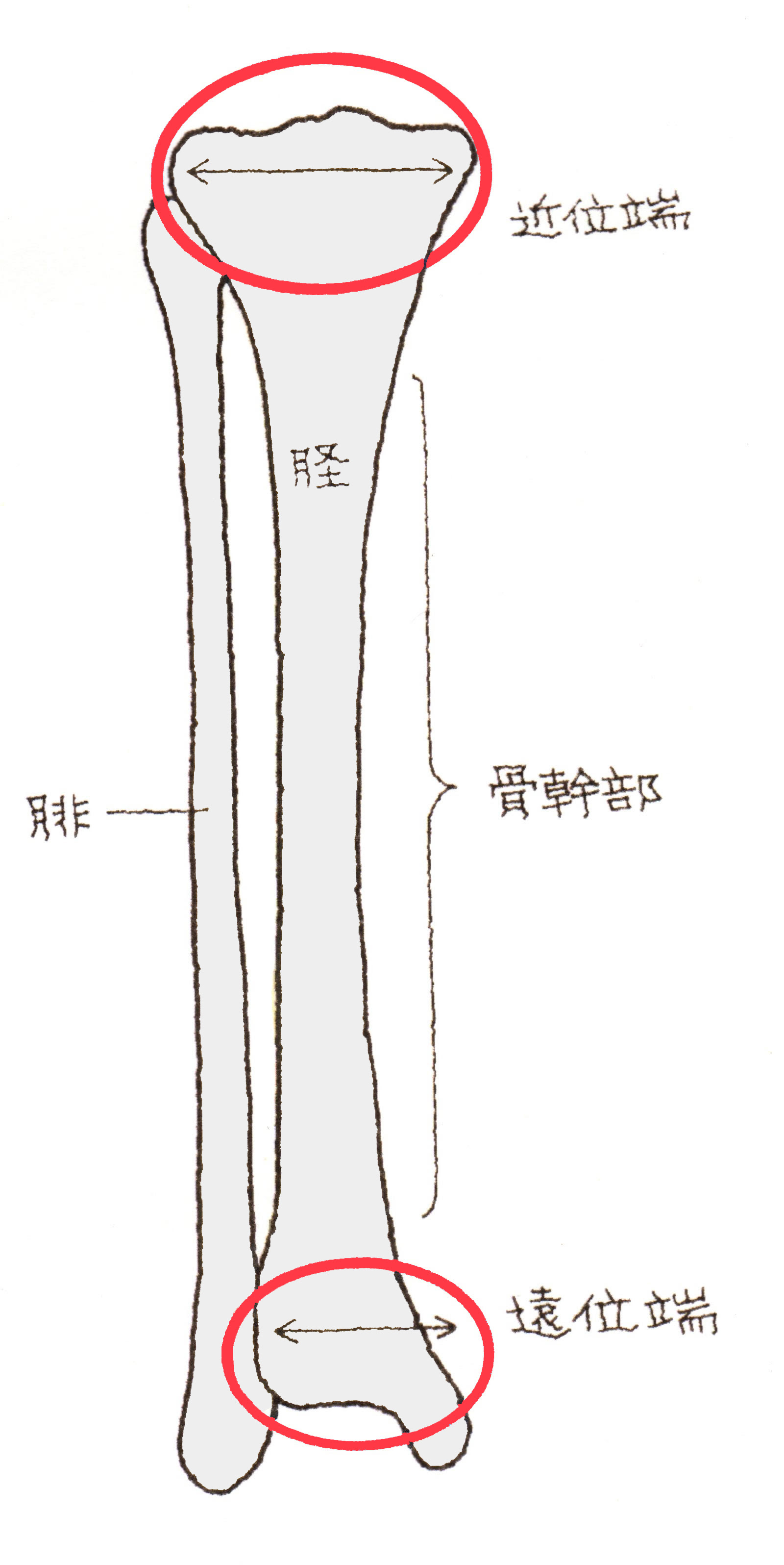 𦙾 腓骨々幹部開放性骨折 けい ひこつこつかんぶかいほうせいこっせつ 福岡の弁護士による後遺障害 等級認定サポート