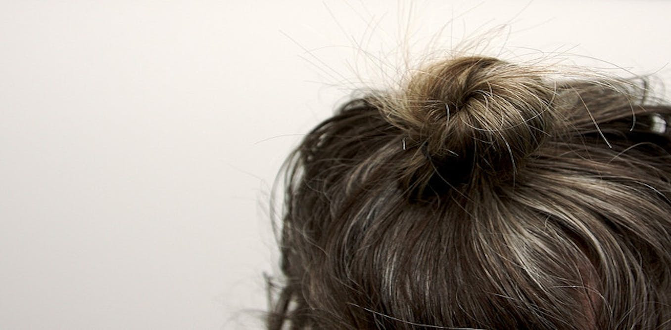 Health Check: why does hair change colour and turn grey?