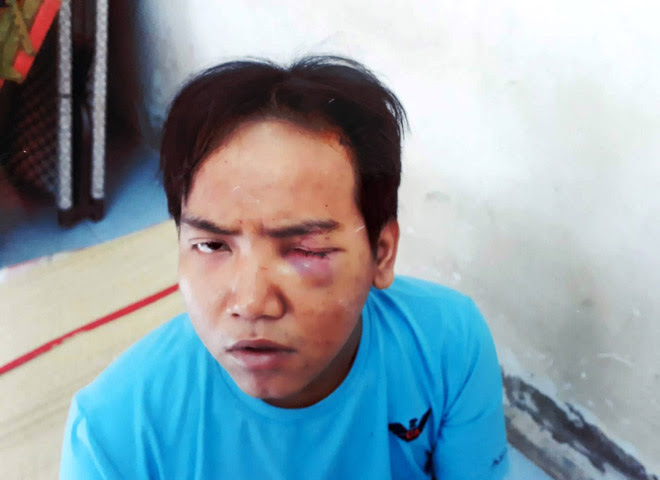 Những cái chết oan uổng khi người tâm thần nổi cơn - 1