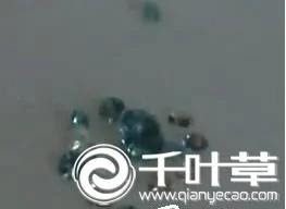 印尼19岁女孩每隔5到15分钟会流出一滴钻石眼泪，被称为钻石眼泪女