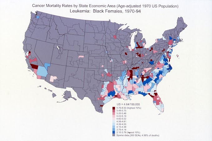 Stage 2 Prostate Cancer Survival Rate / List of cancer mortality rates in the United States - One of the first things that people want to know is the expected survival rate, according to asco.