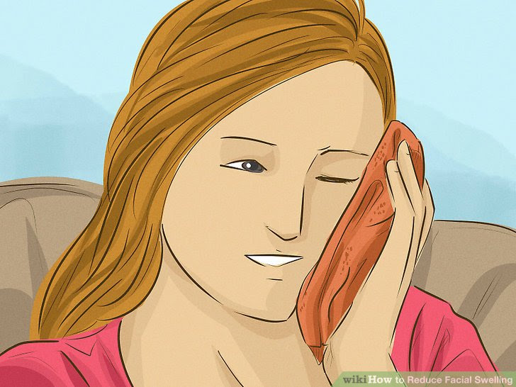 Massage Away a Headache Step 34.jpg
