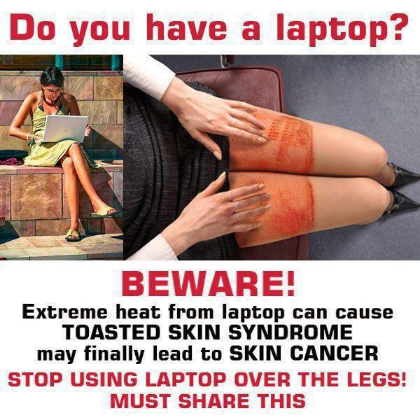 Beware Of Using Laptop Toasted Skin Syndrome Health Blog Centre Info