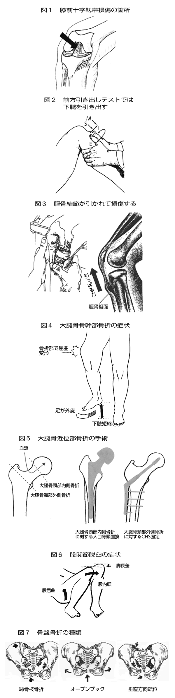 日常診療で使える整形知識 14 Br 整形外科的外傷学各論 5 Br 臨床医学講座より 18年2月4日 医科 学術 研究 兵庫県保険医協会