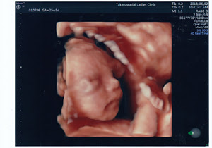 3d 4dエコー 高輪台レディースクリニック 港区の産科 婦人科