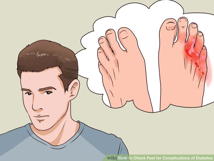 Check Feet for Complications of Diabetes Step 4 Version 2.jpg