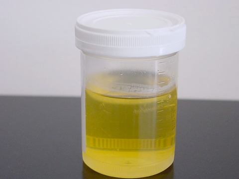 http://static4.businessinsider.com/image/4e07b7f2cadcbbbc61050000-480/pee-piss-urine.jpg