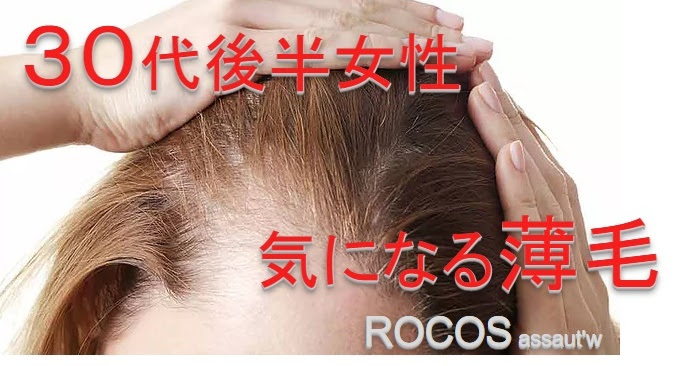 薄毛に悩む３０代後半女性 3つの対策をして 奈良斑鳩町の美容室 髪 ブログ