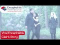 Can You Fully Recovery From Encephalitis?
