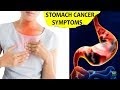 What Are The Symptoms Of Stomach Cancer In Tamil : Types Of Cancers & Symptoms | Healthy Life Baby! | Pinterest : A lump (nodule) that can be felt through the skin on your neck.