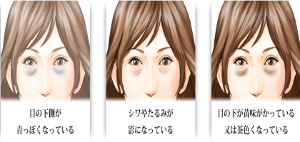 もう目の下のクマで悩まない たるみやシワも改善 目元美人を叶える方法もう目の下のクマで悩まない たるみやシワも改善 目元美人を叶える方法