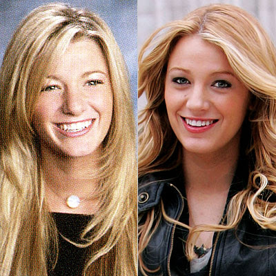 blake lively nose job. Actually not really, Blake was