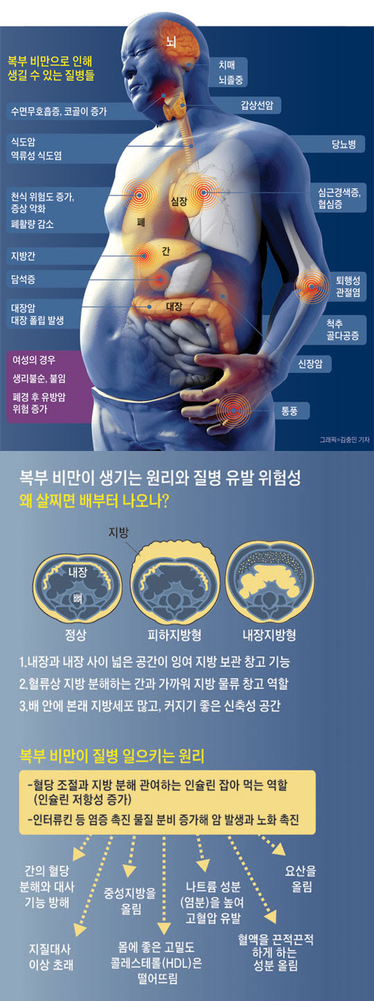복부 비만으로 인해 생길 수 있는 질병들. 복부 비만이 생기는 원리와 질병 유발 위험성.