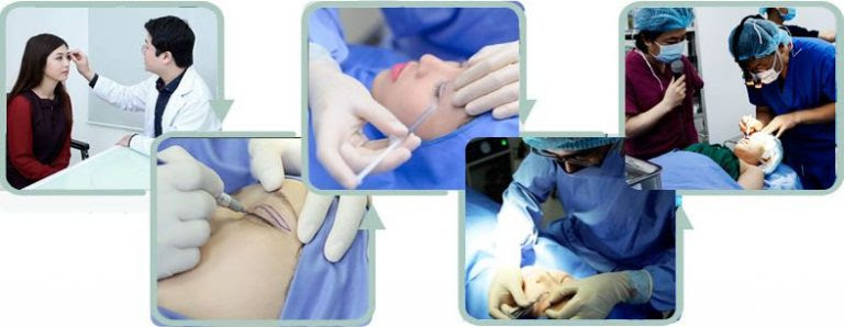 Diễn đàn cắt mí mắt667