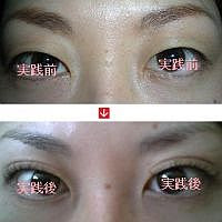 自力で二重まぶたになる簡単な方法