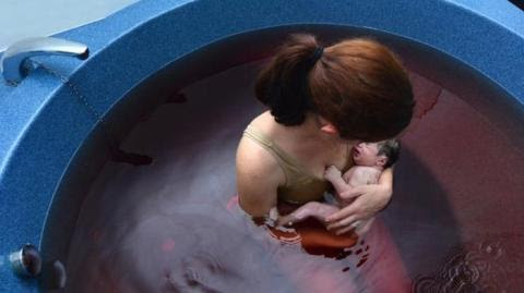 Foto: Cara Andien Aisyah Melahirkan Buah Hatinya, Positif dan Negatif Efek Water Birth http://ift.tt/20kt43r - Berita Terkini Andien Terbaru Hari Ini -Rasa sakit saat melahirkan merupakan hal yang wajar. Water birth atau melahirkan dalam air dipercaya menjadi salah satu metode aman untuk mengurangi keluhan tersebut. Metode ini dilakukan dengan cara menempatkan ibu dalam posisi tertentu dalam sebuat kolam air hangat untuk mempermudah proses kelahiran bayi. Di Amerika Serikat metode ini menjadi salah satu rekomendasi yang diberikan oleh banyak rumah sakit.